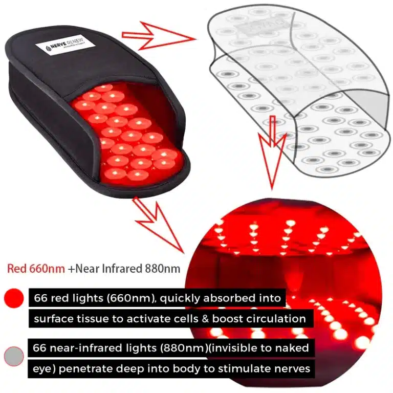 Infrared Light Therapy Boots for Neuropathy: A Comprehensive Solution for Pain Relief